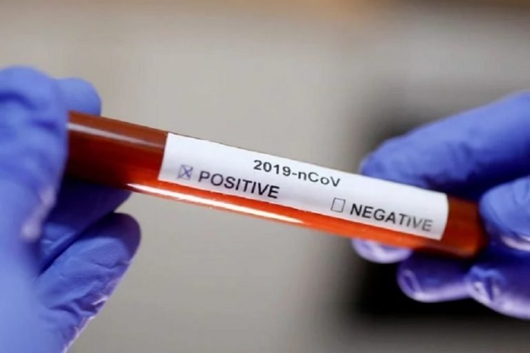 COVID-19: छत्तीसगढ़ में ट्रेवल हिस्ट्री वाले 70 हजार से ज्यादा लोगों को किया गया क्वारंटाइन-COVID 19 More than 70 thousand people with travel history quarantined in Chhattisgarh | chhattisgarh – News in Hindi