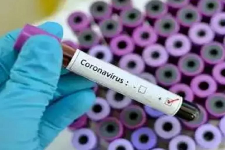 जगदलपुर में होम आइसोलेटेड महिला की मौत, प्रशासन हुआ अलर्ट, corona virus update news home isolated women dead in jagdalpur administration alert | bastar – News in Hindi