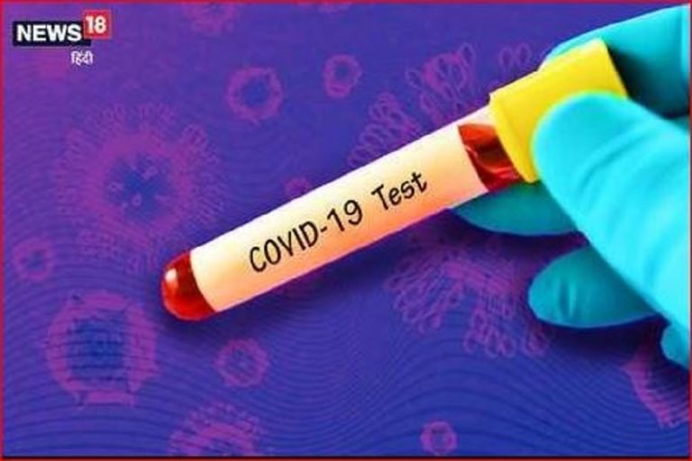 सूरजपुर: COVID-19 रैपिड टेस्ट में पुलिस कॉन्स्टेबल समेत 9 पॉजिटिव, लैब टेस्ट रिपोर्ट का इंतजार COVID-19: 9 positives including police constable in rapid test in Surajpur, awaiting lab test report | raipur – News in Hindi
