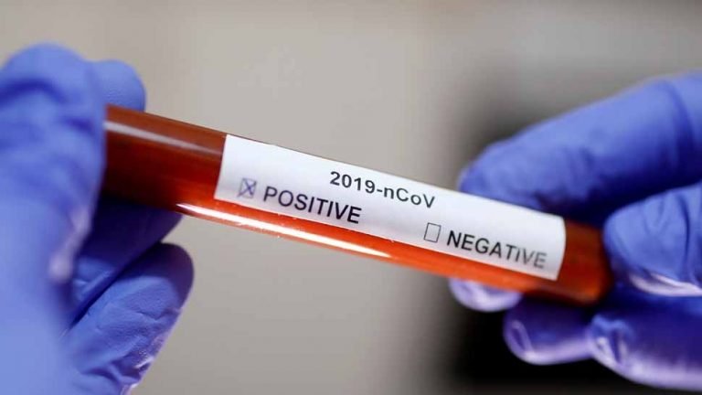 Coronavirus caused havoc in USA, killing nearly 2000 people for the second consecutive day | Coronavirus से अमेरिका में हाहाकर, लगातार दूसरे दिन करीब 2000 लोगों की मौत