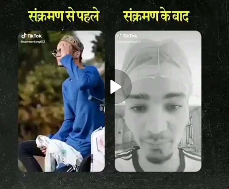 मास्क का मजाक उड़ाने वाले टिकटॉक स्टार को हुआ कोरोना तो वीडियो जारी कर गिड़गिड़ाने लगा