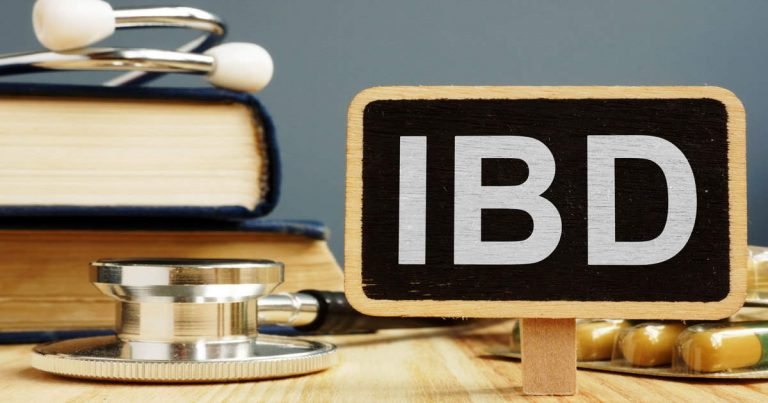 Inflammatory Bowel Disease: Inflammatory Bowel Disease: सिर्फ बवासीर नहीं, इस बीमारी में भी आ सकता है मोशन में ब्लड – inflammatory bowel disease reason symptoms and treatment