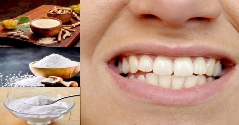 Home Remedy For Bleeding Gums: Home Remedy For Bleeding Gums : मसूड़ों से आ रहा है खून तो इस आयुर्वेदिक जड़ी बूटी में मिलाएं यह 2 चीज, मिल सकती है मदद – home remedies for bleeding gums with ashwagandha powder ashwagandha powder benefits in hindi