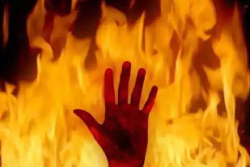 रेप पीड़िता ने खुद को लगाई आग, पिता और बेटा लगा रहे न्याय की गुहार | kawardha – News in Hindi