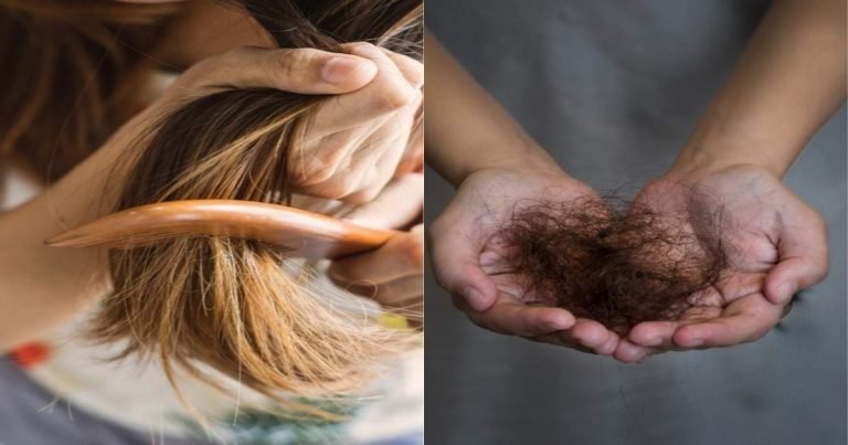 hair fall ayurvedic remedies: Hair fall remedies: एक ही बार में बालों का गिरना होगा कम, इस घरेलू नुस्‍खे से उग आएंगे नए बाल – hair fall and hair growth remedies at home with ginger and kali mirch solution