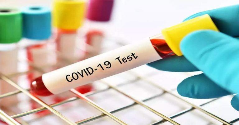 corona report false negative: Coronavirus Test false Negative: कोरोना की रिपोर्ट नेगेटिव होने पर भी इसके संक्रमण से ग्रसित हो सकता है मरीज – the patient may suffer from infection even after the corona report is negative in hindi