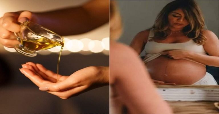massage oil for stretch marks: न करें बेकार की क्रीम पर पैसे बर्बाद, 7 दिन में इस मसाज ऑयल से मिट जाएंगे प्रेग्नेंसी के स्ट्रेच मार्क्स – how to make pregnancy stretch mark massage oil at home with easy steps