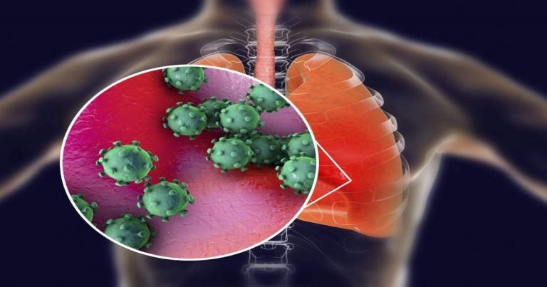 coronavirus effects on lungs: Covid 19 Effect On Body : फेफड़ों को डैमेज कर सकता है बिना लक्षण वाला कोरोना वायरस, इन 2 तरीकों से पहुंचा रहा नुकसान – covid 19 asymptomatic patients of coronavirus can increase the chances of lung damage
