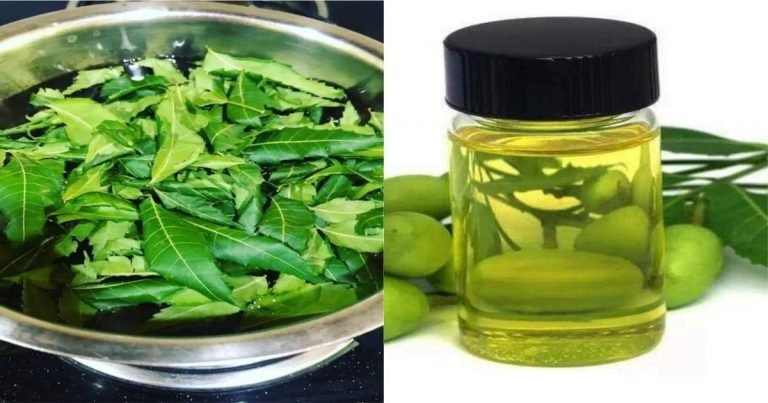 neem oil lightens skin: Neem Skin Care: गुणों का खजान है नीम का तेल, जानें त्‍वचा पर लगाने का फायदा – how to use neem oil for the skin pigmentation acne and infection