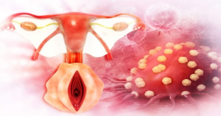 best yoga for polycystic ovary disease: PCOD की समस्या से बची रहती हैं वे महिलाएं, जिनके रुटीन में हैं ये 3 योग – health benefits of yoga for pcod or polycystic ovary disease in hindi