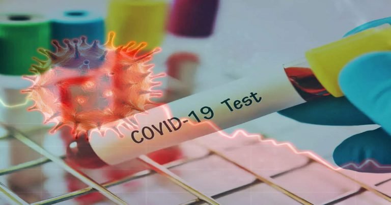 what to do if get exposed to covid patient: Exposed To Covid-19 Positive: जिससे आप मिलकर आए हैं वो कोरोना संक्रमित निकले तो क्या करना चाहिए? – what to do if you get exposed to a covid-19 positive in hindi