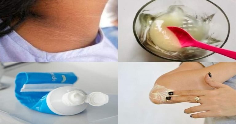 remedy for dark neck: Dark Neck Remedy: 15 मिनट में सालों पुरानी गर्दन पर जमी मैल होगी दूर, टूथपेस्‍ट में मिलाकर लगाएं बस ये 2 रु की चीज – home remedies how to remove dark skin from neck elbows knees in 15 minutes