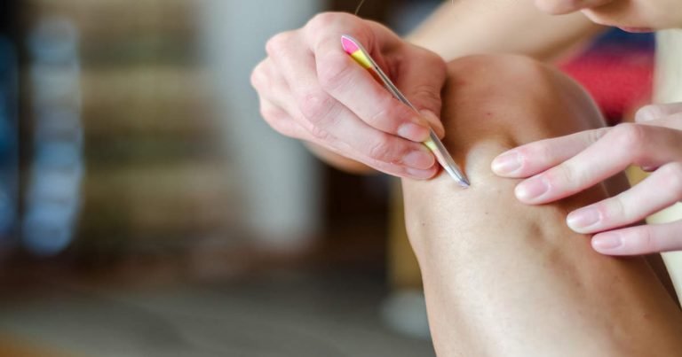 how to get rid of ingrown hair: Body Care Tips: इनग्रोन हेयर से खूबसूरती पर लग सकता है दाग, जानें इससे छुटकारा पाने का आसान तरीका – what is ingrown hair effective ways to get rid of it in hindi