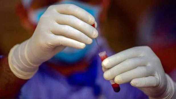 दिल्ली में कोरोना टेस्टिंग ने पकड़ी रफ्तार, संक्रमण दर में भी आई कमी – Coronavirus delhi covid 19 testing rate increase but corona positive cases decrease