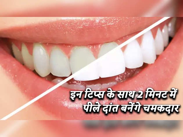 इन टिप्स के साथ 2 मिनट में पीले दांत बनेंगे चमकदार इन टिप्स के साथ 2 मिनट में पीले दांत बनेंगे चमकदार