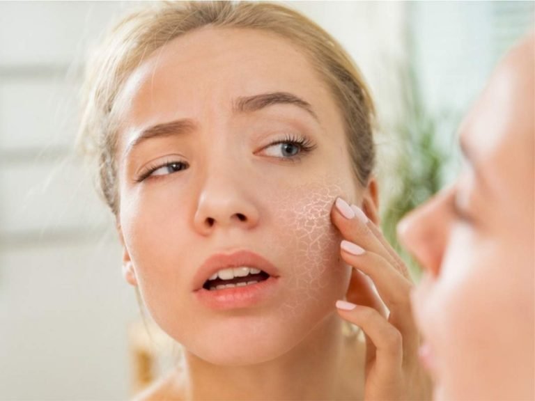 best dry skin ingredients: Dry Skin वाली लड़कियां न हों परेशान, ये 5 चीचों से रखें चेहरे का ध्‍यान – 5 ingredients to kiss dry skin goodbye