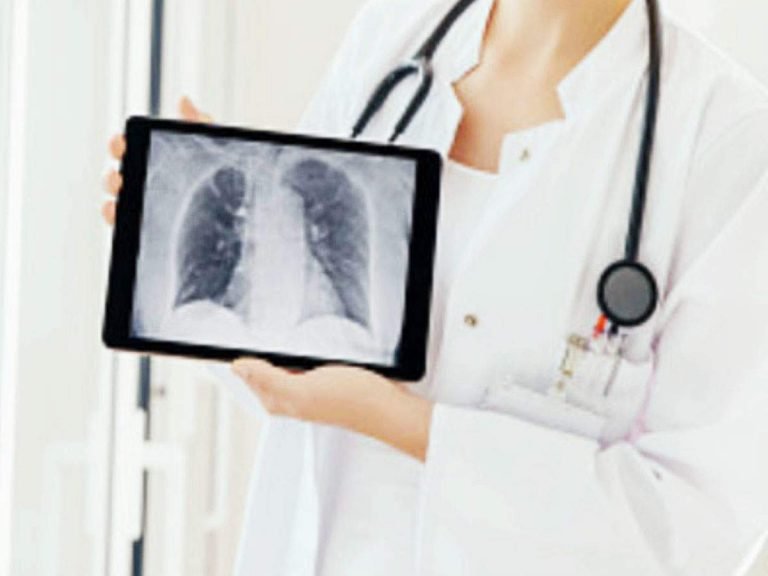 Test Before organ donation: Tests Before Organ transplantation: इन दो मैच के बिना नहीं होता अंग प्रत्यारोपण – tests before organ donation and transplantation what is hla matching and blood testing in hindi