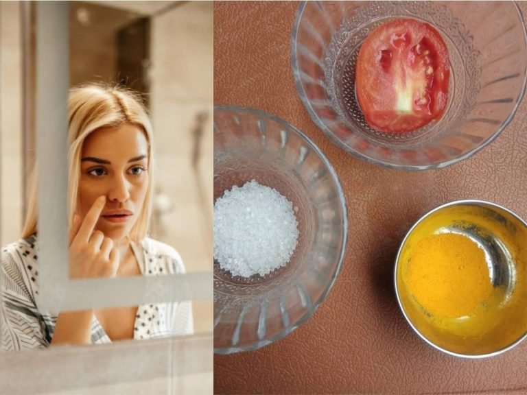 tomato for acne: Acne-prone skin के लिए बेस्‍ट है टमाटर के ये 3 उपाय, ऐसे करें अप्‍लाई – tomato for skin remove acne and pimples with these 3 easy tomato face packs