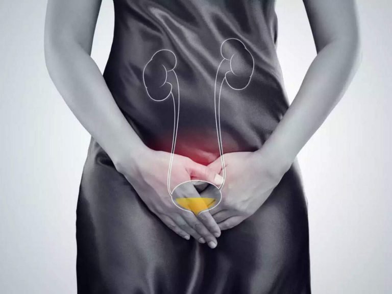 reasons of burning urination: Burning Urination (Dysuria): यूरिन करते समय जलन-दर्द के कारण और इनके घरेलू उपचार – feel burning while passing urine reasons and home remedies for this health problem in hindi
