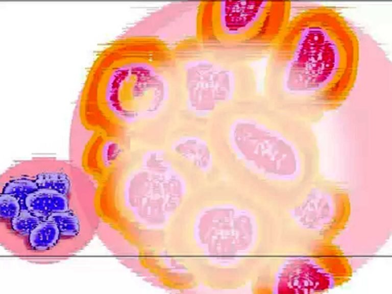 nipah virus symptoms in hindi: Nipah Virus Infection Symptoms: निपाह वायरस के लक्षण और इससे बचने के तरीके – nipah virus infection symptoms and treatment in hindi