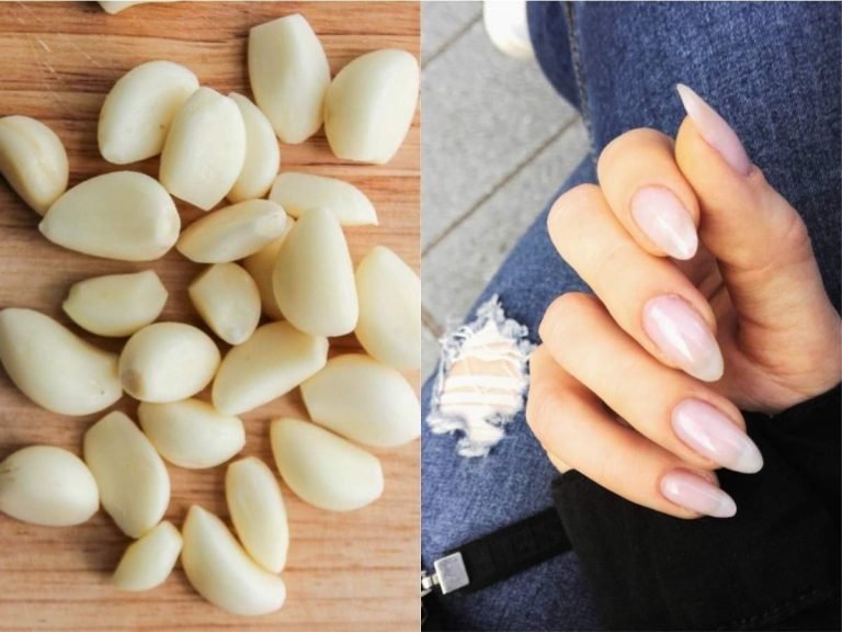 how to use garlic for nail growth: Home Remedies: 10 गुना तेजी से बढ़ेंगे नाखून, रात में सोने से पहले लगाएं लहसुन और ये तेल – nail care tips apply this diy garlic and coconut oil nail serum at night for fast nail growth