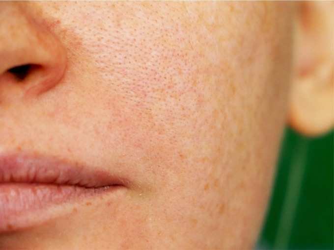 pores pores