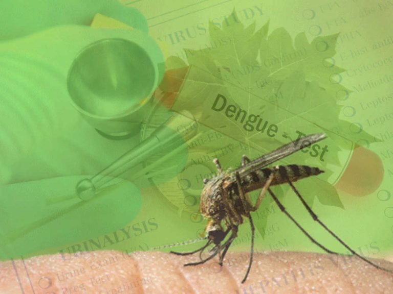 dengue preventive food: Dengue Preventive Food: डेंगू से बचने के लिए क्या खाना चाहिए और क्या नहीं, यहां जानें – what to eat for dengue prevention and what should not eat during dengue in hindi