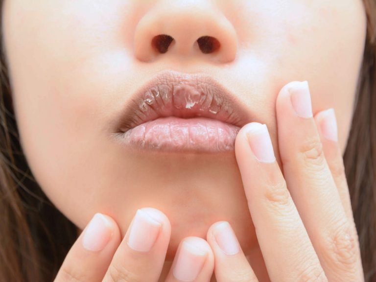 coconut oil for lips: कॉस्मेक्टिक्स से करें तौबा, इन प्राकृतिक तरीकों से पाएं सॉफ्ट पिंक लिप्स – coconut oil for lips home remedies for chapped lips in hindi