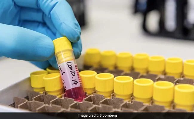 Delhi Coronavirus Update: 1544 new cases of covid-19 reported, 17 patients died