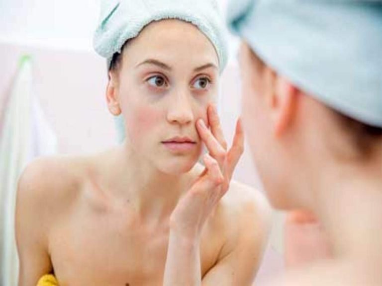 काले घेरों का घरेलू इलाज: Home Remedies: क्या नारियल के तेल से हमेशा के लिए मिलता है काले घेरों से छुटकारा? पढ़ें – home remedies dark circles under eyes how to get rid of it permanently in hindi