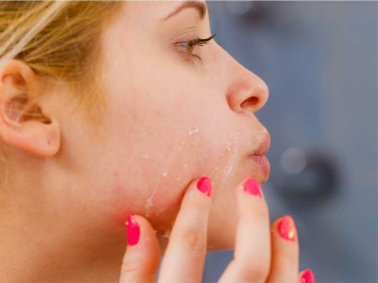 how to maintain ph level of face: नहीं चाहती चेहरे पर हों मुंहासे-झाइयां और काले धब्‍बे, तो स्‍किन का pH लेवल ऐसे रखें बैलेंस – 3 tips to maintain ph balance of skin