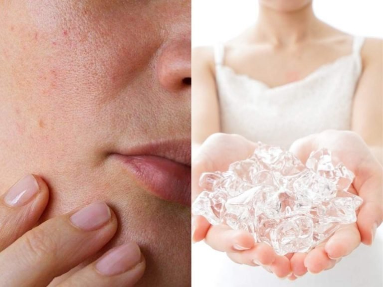 ice cube on face everyday: चेहरे के ओपन पोर्स को बंद करता है Ice Cube, बस पांच मिनट में मिलती है टाइट स्‍किन – how to shrink large open pores with ice cubes