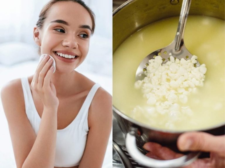 sour milk for acne: फटे दूध के पानी से चेहरे के लिए बनाएं Face Serum, स्‍किन बनेगी ब्राइट और स्‍मूथ – soured milk face serum can lighten skin tones and make it smooth and firm
