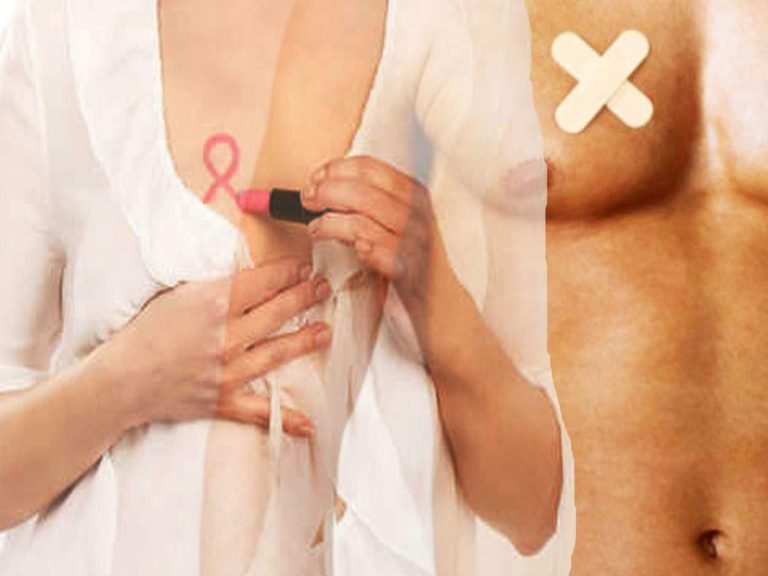 symptoms of vitamin D deficiency: Common Reason For Breast Cancer: ब्रेस्ट कैंसर की संभावना बढ़ा देती है इस विटमिन की कमी, इन 5 लक्षणों से पहचानें – lack of vitamin d may be the reason of breast cancer as it is a common symptoms in patients of this disease in hindi
