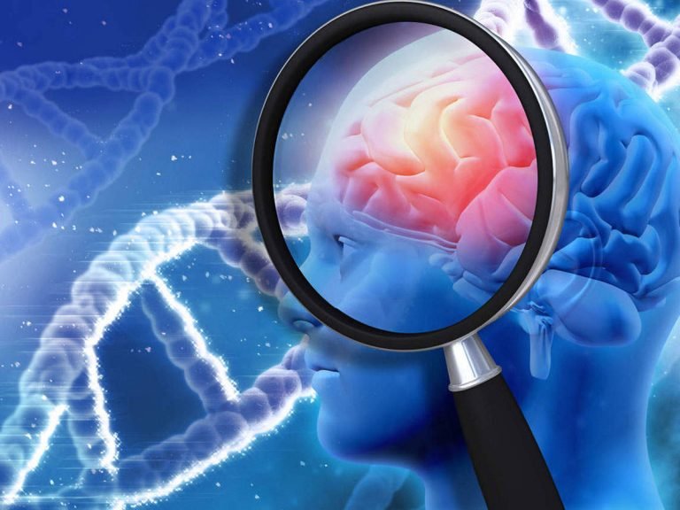 brain stroke prevention and treatment: Need To Know About Brain Stroke: ब्रेन स्ट्रोक के बाद ‘दादी सा’ ने की घर वापसी, जानें बीमारी से जुड़ी जरूरी बातें – actress surekha sikri brain stroke symptoms prevention and treatment
