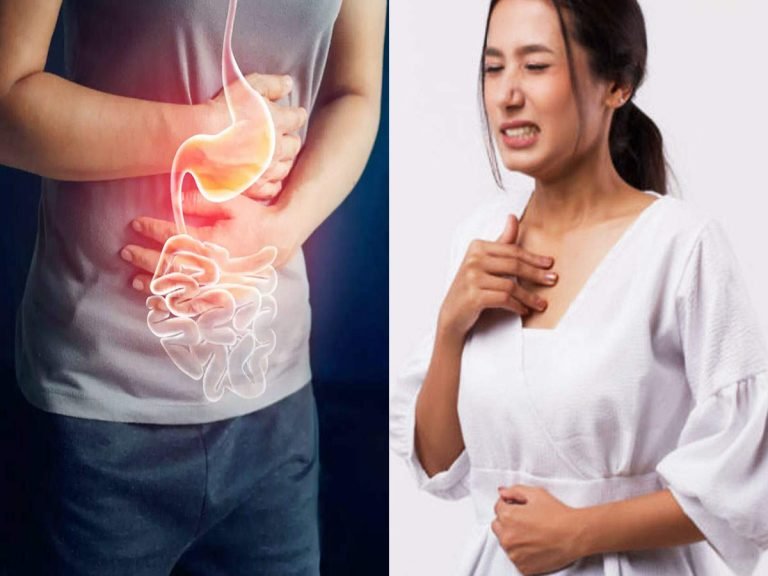 home remedies for indigestion: Indigestion And Gas: बदहजमी से राहत दिलाती है स्वादिष्ट हरड़, भोजन के बाद इस तरह खाएं – harad is the best way to avoid digestive issues like stomach gas or indigestion