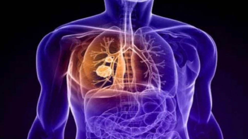 COVID-19 patients suffer long-term lung, heart damage but it can improve with time: Study | कोरोना से फेफड़े-दिल को हो रहा नुकसान, लंबे समय तक झेलनी पड़ती हैं परेशानियां, लेकिन…