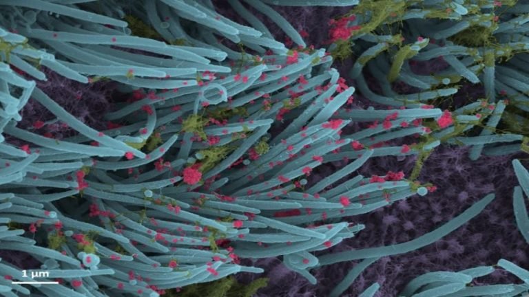 Picture in graphic details, looks like something close to new Coronavirus | ग्राफिक डिटेल्स में सामने आई तस्वीर, करीब से कुछ ऐसा दिखता है नया Coronavirus