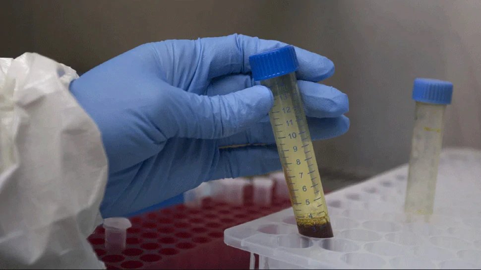 Coronavirus: new global test will now give results in just a few minutes | Coronavirus: नया ग्लोबल टेस्ट अब महज कुछ ‘मिनट’ में देगा परिणाम