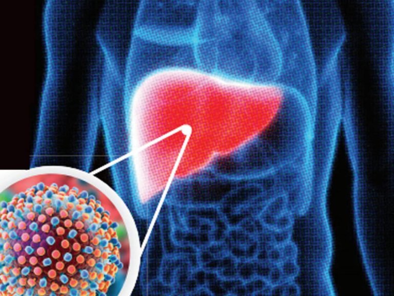 symptoms of chronic hepatitis-c: Hepatitis-C Virus: क्रॉनिक हेपेटाइटिस-सी के लक्षण और बीमारी से जुड़ी जरूरी बातें – hepatitis-c virus discovery and medicine nobel prize 2020 symptoms of chronic hepatitis c