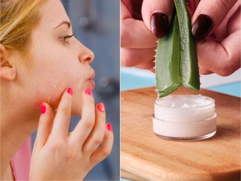 homemade serum for dry skin: सर्दियों में ड्रायनेस दूर करने के लिए Aloe vera से बनाएं ये फेस सीरम, आएगा हीरे जैसा निखार – winter skincare routine how to get rid of dryness with this alo vera vitamin e hydrating serum at home