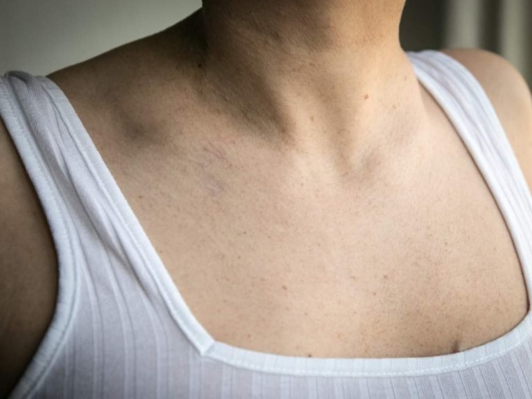 how to get rid of dark neck in 20 minutes: गर्दन पर पड़ी झाइयों को जड़ से खत्‍म करेंगे ये घरेलू उचार, नहीं पड़ेगी क्रीम लगाने की जरूरत – how to get rid of dark neck or pigmentation from home remedies