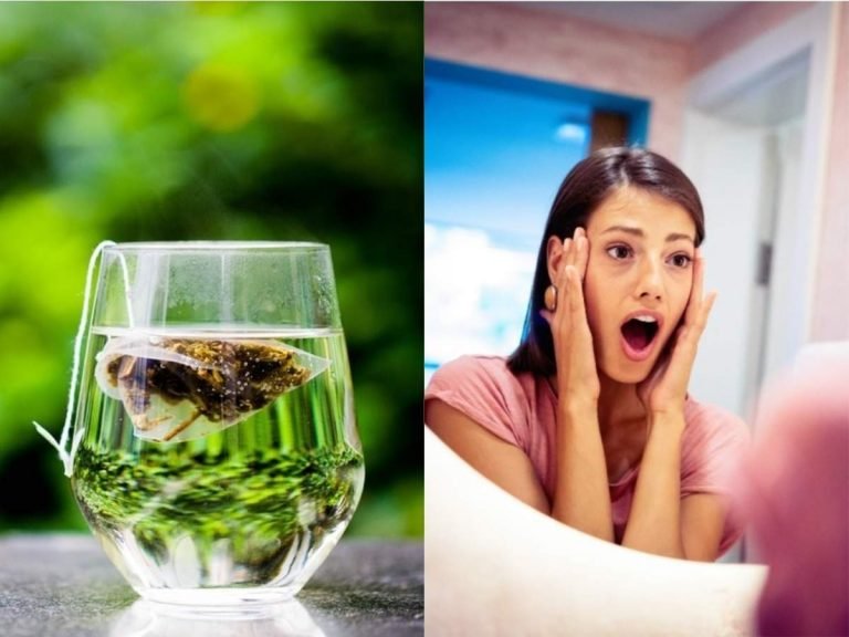 green tea pimples: मिल सकता है Acne से हमेशा के लिए छुटकारा, Green Tea का ऐसे करें इस्‍तेमाल – you can get rid of acne forever know how to use green tea