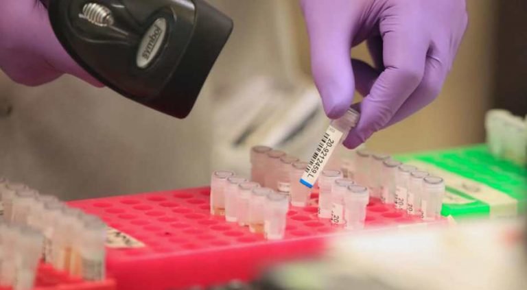 UK has biggest one-day jump in confirmed COVID-19 cases| ब्रिटेन में कोरोना ने फिर पकड़ी रफ्तार, एक दिन में सामने आए सबसे ज्यादा मामले