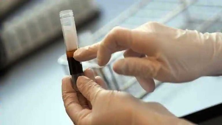 Does plasma therapy help corona patients? This study reveals shocking results | क्या Plasma Therapy से कोरोनो रोगियों को होता है फायदा? चौंकाने वाले परिणाम आए सामने