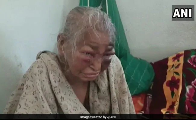 बंगाल BJP का आरोप- TMC के गुंडों ने पार्टी कार्यकर्ता की मां को बेरहमी से पीटा