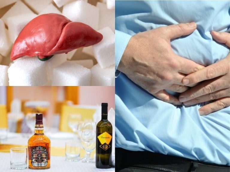 fatty liver ki bimari: हल्‍के में लेंगे तो लिवर तक डैमेज कर सकती है ये बीमारी, जानें Fatty liver disease के बारे में सब-कुछ – fatty liver disease can damage the liver symptoms causes risks and treatment