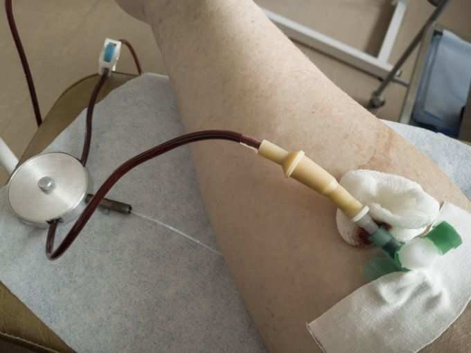 -plasma-therapy- -plasma-therapy-