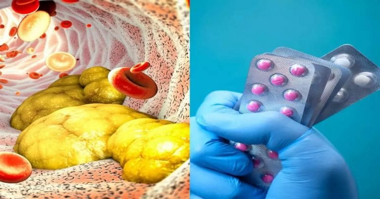 Cholesterol medicine: मेयो क्लिनिक ने बताई 5 दवाएं, खून में जमा कोलेस्ट्रॉल को आसानी से कर सकती हैं खत्म – according to mayo clinic 5 best medicines to lower bad cholesterol and increase good cholesterol