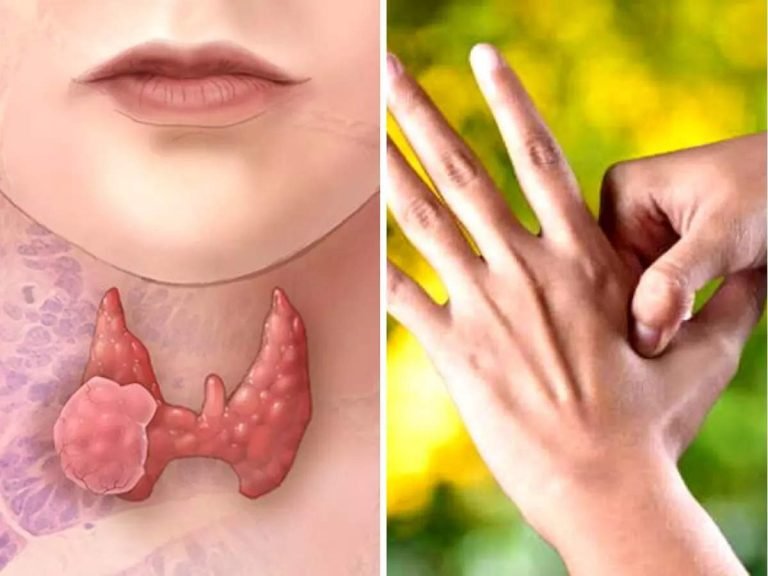 how can i naturally normalize my thyroid, नहीं पड़ेगी दवा की जरूरत, Thyroid को कंट्रोल रखने के लिए Ayurveda के बस ये 4 उपाय हैं काफी – ayurveda doctor dixa bhavasar shared 4 tips to manage thyroid health beyond medicine at home